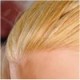 Blonde - Hair Transplant  + $350.00 